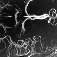 Angiography